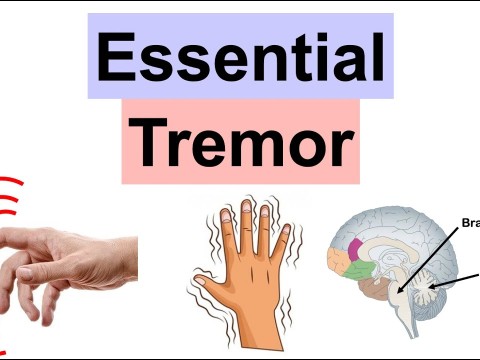 tremor