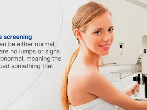 mammogram