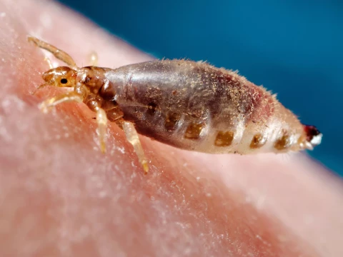 louse