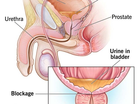 urinary