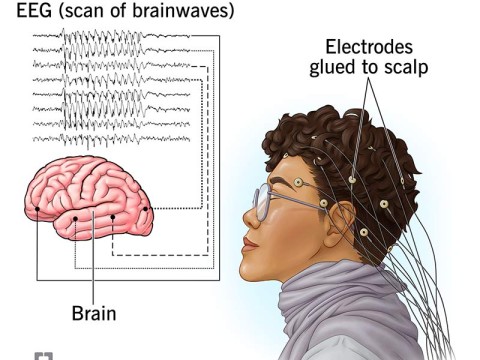 electroencephalograph