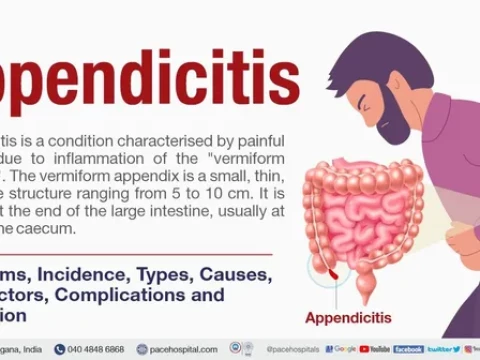 appendicitis