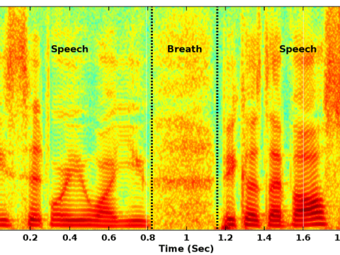 spectrogram