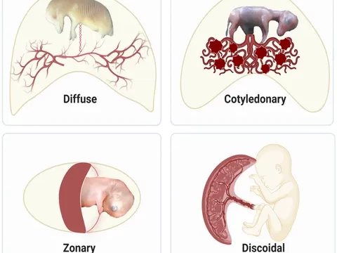 zonary