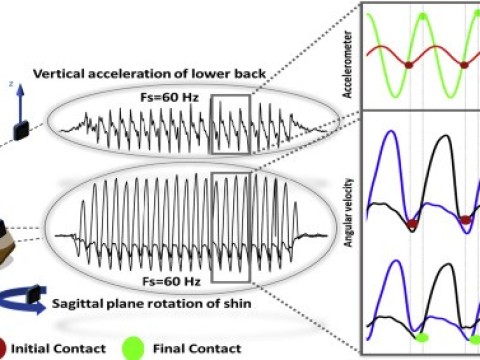 accelerometer
