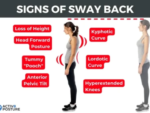 swaybacked