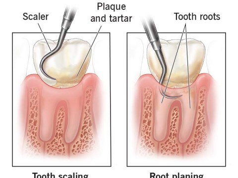 scaler