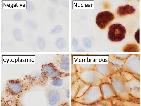 immunohistochemistry