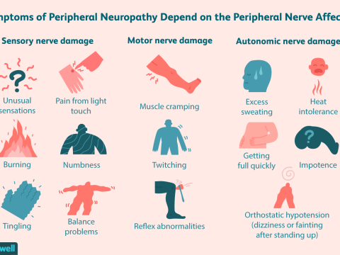 neuropathy