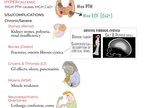 hyperparathyroidism