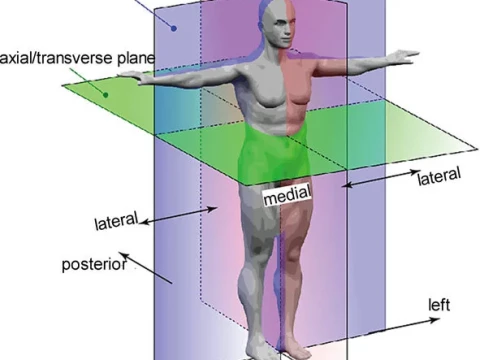 transversely