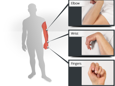 spasticity