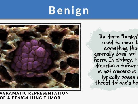 benign