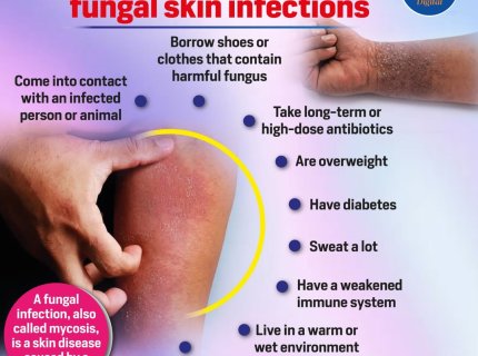 fungal