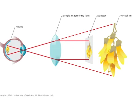 magnification