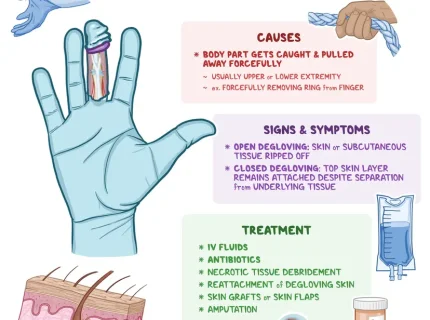 gloved