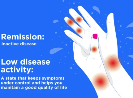 remission