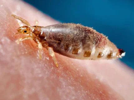 louse