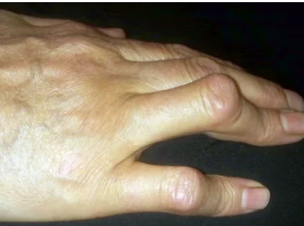 deformity