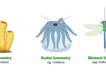 radial