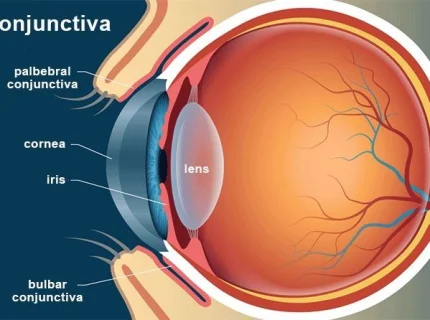 conjunctival