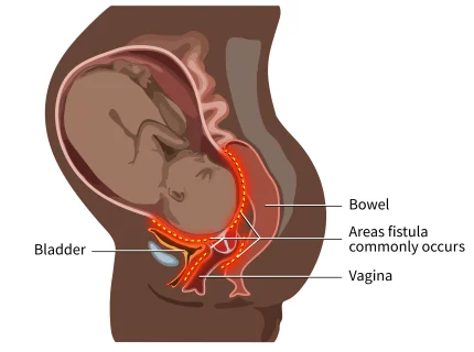 obstetrical