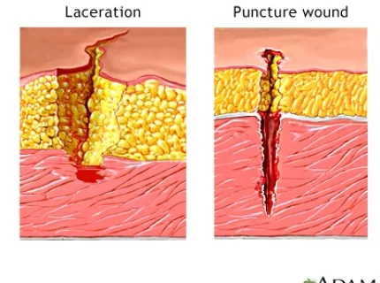 punctured