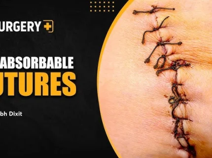 absorbable