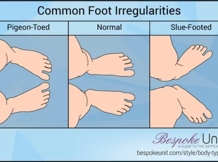 toed