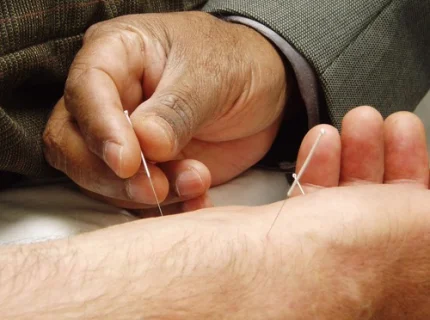 acupuncturist