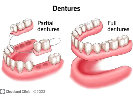denture