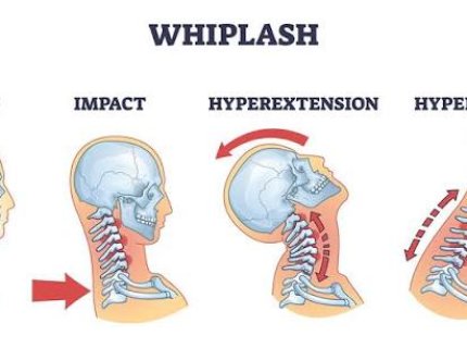 whiplash