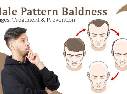 baldness