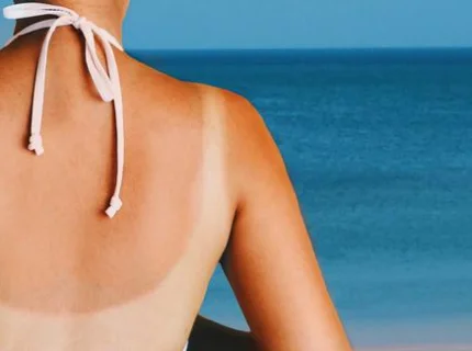 suntanned