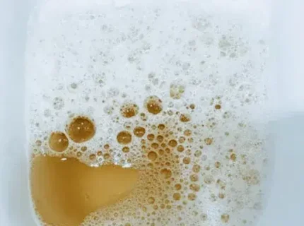 foamy