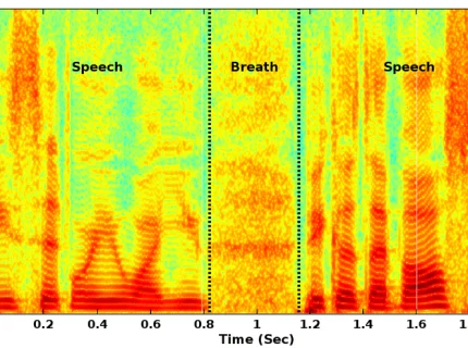 spectrogram