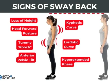 swaybacked
