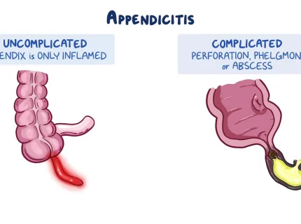 appendicle