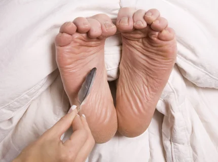 tickling