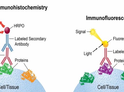 immunochemistry