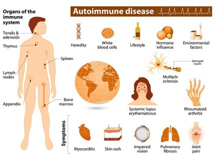 immunologic
