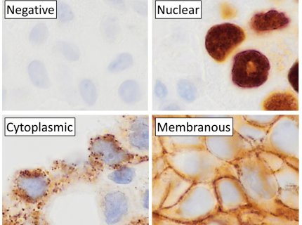 immunohistochemistry