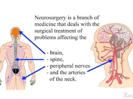 neurosurgery