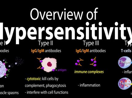 hypersensitivity