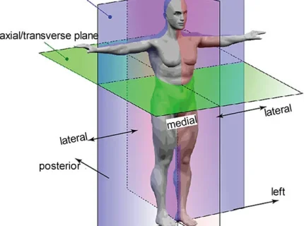 transversely