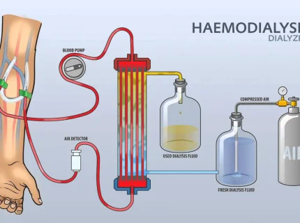 dialyzer