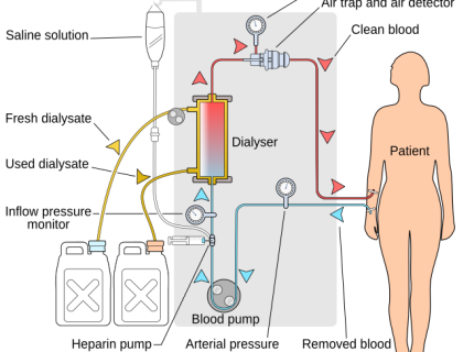 dialyze
