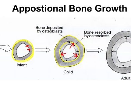 appositional