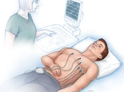 electrocardiographic