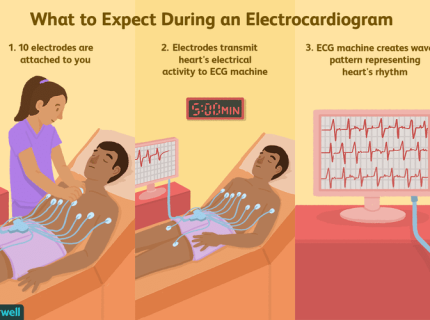 electrocardiograph